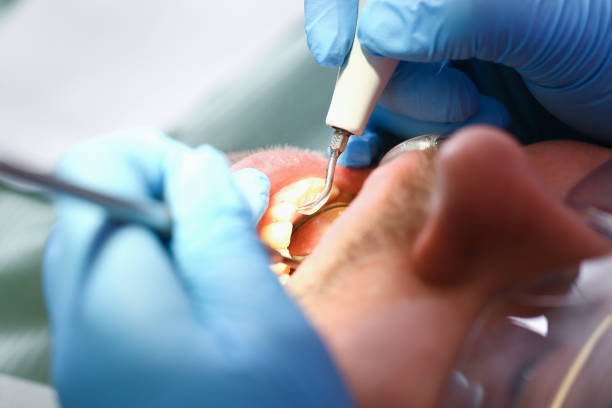 Best Mobile Emergency Dentist in East Harwich, MA