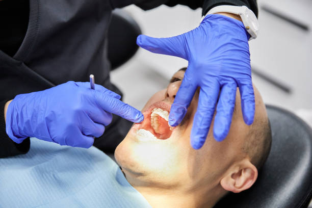Best Broken or Cracked Tooth Emergency Dentist in East Harwich, MA
